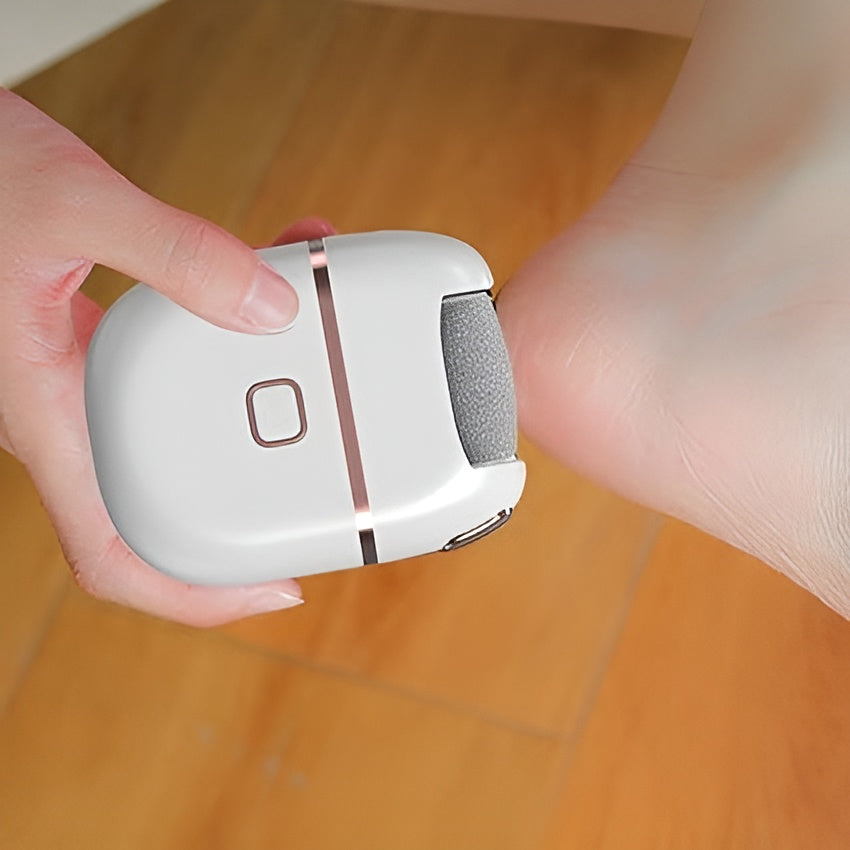 Removedor Eléctrico de Callos – Disponible en NQLN Store con envío gratis desde $20